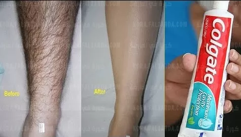 إزالة الشعر بمعجون الأسنان التخلص من شعر العانة بدون ألم أو حك