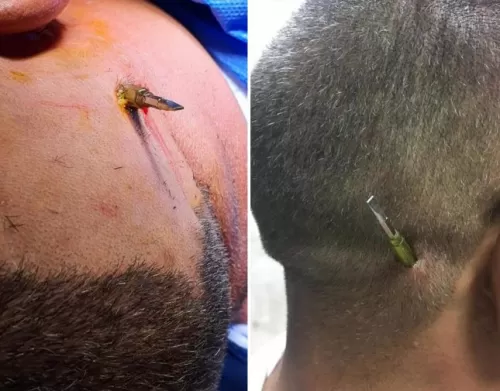 شاهد فتاة مصرية تعتدي على شاب طلبها للزواج وتضربه بمفك في رأسه