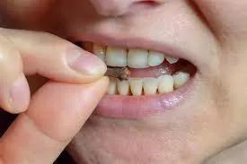 حبة القرنفل تحت اللسان كل صباح هكذا تغير حياتك