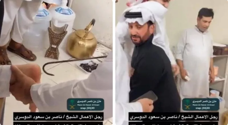 شاهد: رجل الاعمال احمد العبيكان يكوي رجله بالنار ليتداوى من هذا المرض