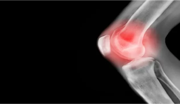 تخلص من الام المفاصل نهائياً مع هذا المشروب السحري الرهيب