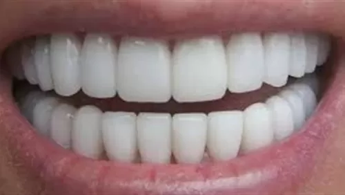 تخلص من اصفرار الأسنان بوصفة منزلية سحرية تمنحك ابتسامة ناصعة البياض خلال دقائق