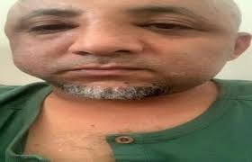 الاعتداء بالضرب على الناشط جلال الصلاحي بتركيا