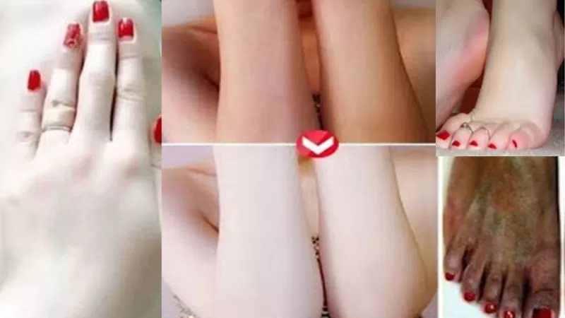 بالفيديو ستدهشك المعجزة التي ستراها عند وضع خلطة الحلبة والخميرة على هذه المناطق الحساسة جداً من جسم المرأة