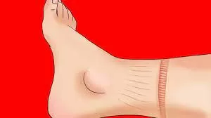 اعراض بسيطة لكنها مؤشر خطير .. على بدايات انسداد الشرايين !