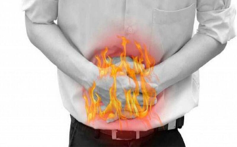 كيف تتخلص من حموضة المعدة؟
