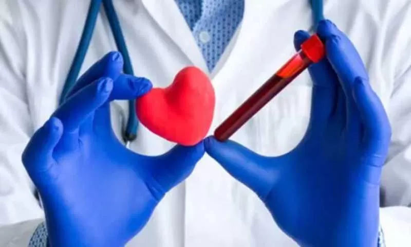 ارتفاع نسبة الكوليسترول: العامل ”النفسي” الذي قد يعرضك لخطر أكبر