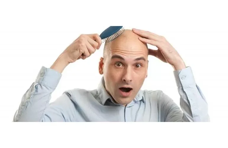 هذه الوصفة المعجزة الحقيقية للقضاء على الصلع واستعادة الشعر خلال عشرين يوم والنتائج اذهلت الأطباء