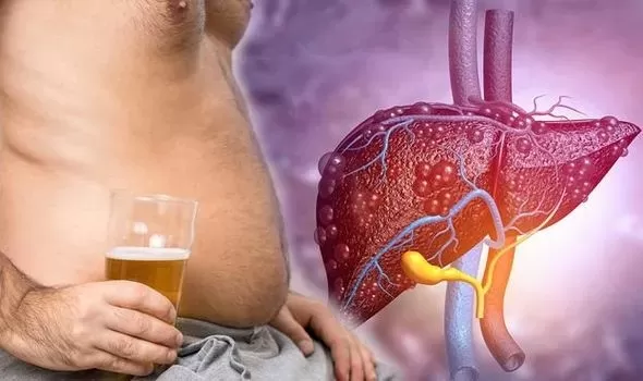 علامات واضحة على الجلد تؤكد ان كبدك في خطر حقيقي