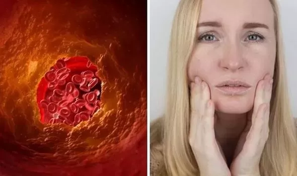 علامات واضحة تدل على ان الدم مشبع بالدهون الضارة وان خطر الجلطة على حياتك اكثر من اي وقت مضى