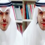 شاهد.. أخصائي نفسي يحذر الرجال من الزواج من النساء المطلقات