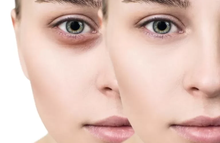 لماذا يجب عليك استخدام زيت الخروع على هذا الجزء من الوجه ؟