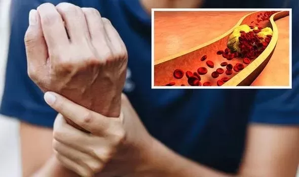 اذا ظهرت هذه العلامات في وجهك فقد اصبت بالسكري واترفع السكر التراكمي في دمك لمستويات خطيرة وهذا اول شيء يجب عليك فعله