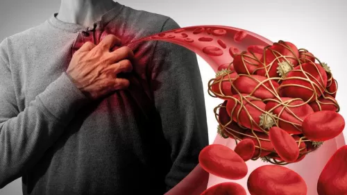 هذه المشروبات تحميكم من الجلطات وموجودة في كل بيت