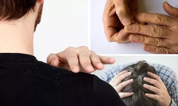 4 علامات واضحة لا تخطئها العين تدل على نقص فيتامين B12 الهام للجسم .. تعرف عليها