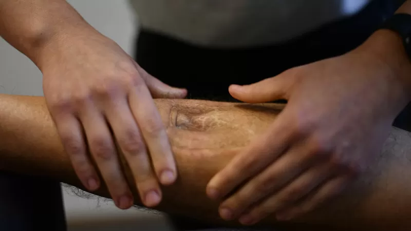 علامات في ساقيك تدل على ارتفاع مستويات الكوليسترول الخبيث