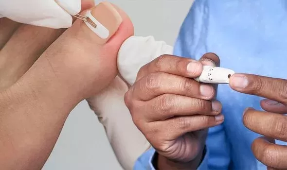 بينها اثار تظهر على اظافر القدمين .. ما هي اثار ارتفاع السكر التراكمي في الدم؟