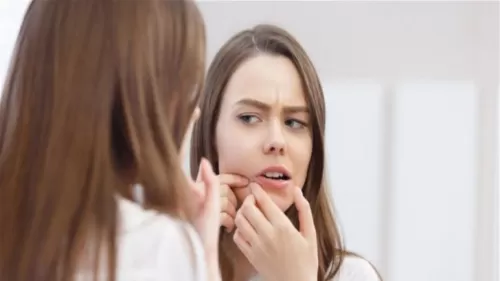 اطعمة شائعة تزيد ظهور حب الشباب