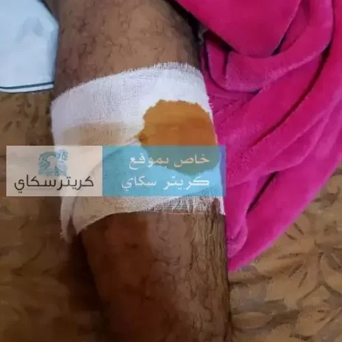 شاهد بالصور: حرس الحدود العُماني ينكل بالحريزي وشخص كان برفقته