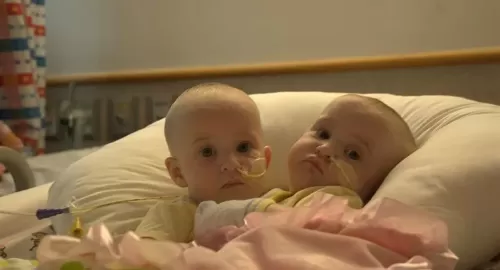 شاهد: صور لا تصدق لتوأم احدهما ابيض والأخر اسود وهذا هو السبب الصادم