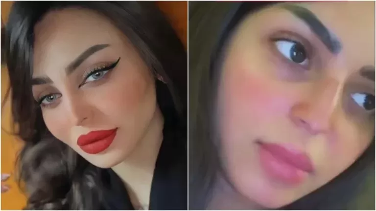 بالفيديو: السعودية رهف القحطاني تعلق على شكل أنفها
