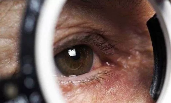 مكون طبيعي واحد يحمي شبكية العين عند مرضى السكري من التلف بسبب ارتفاع الجلوكوز في الدم