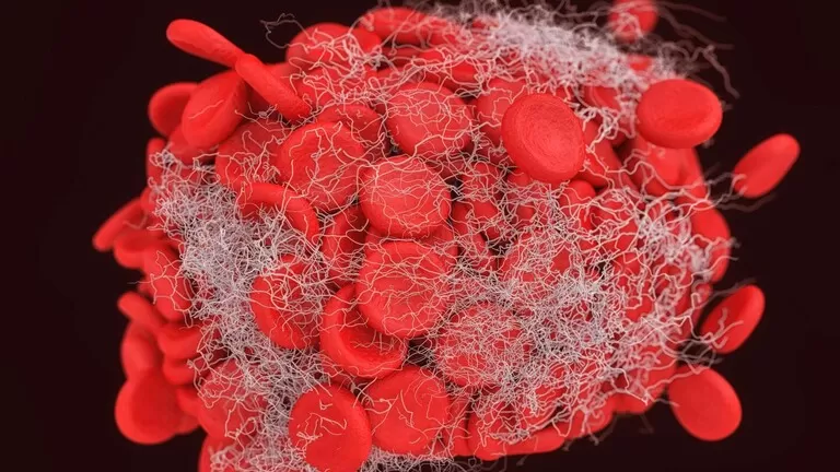 اربع علامات واضحة على تكون جلطات دموية تهدد حياتك تعرف عليها الأن قبل فوات الأوان