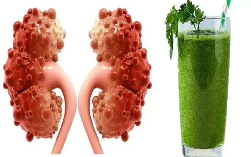 9 مشروبات تغسل الكلى وتنظف الكبد من السموم .. إحرص على تناولها بعد الإفطار في رمضان ’’تعرف عليها’’ !!