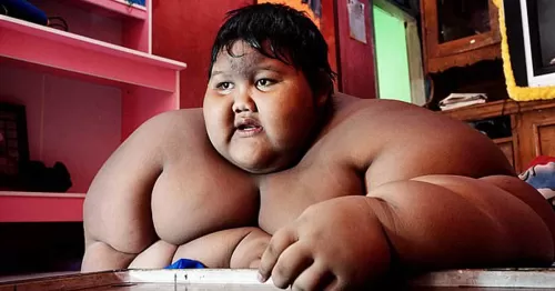 وصفوه بأثقل طفل في العالم فقرر أن ينقص وزنه .. هكذا أصبح شكله الآن !