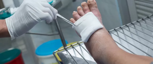 هام لمرضى السكري .. أعراض القدم السكري ومضاعفاتها الخطيرة!