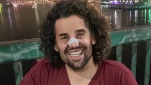 شاهد حسين الجسمي بعد عملية تجميل غيرت شكله تماماً واصبح كائن اخر