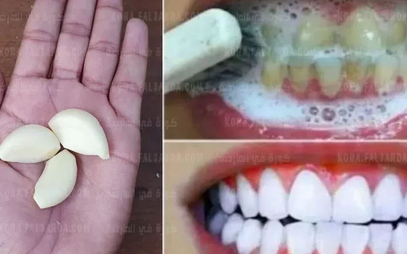 وداعاً لاصفرار الأسنان والتسوس وبدون فرشاة ومعجون احصل على اسنان بيضاء بهذه العشبة الطبيعية من المنزل خلال ايام فقط