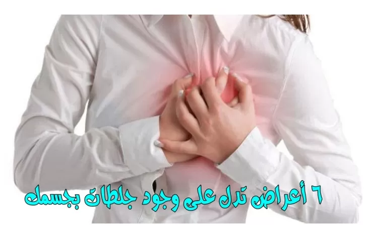 ما هي الجلطات الشتوية؟ وكيف تحمي نفسك منها وما هي اعراضها ؟