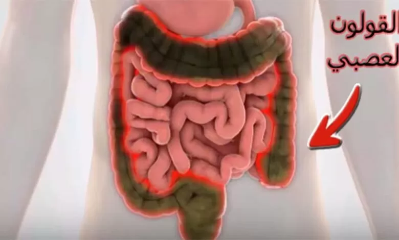 تخلص من الم القولون الآن