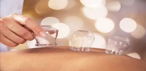 لن تصدق: الحجامة تعالج كل هذه الأمراض