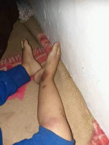 في ثاني جريمة مروعة.. ”يمنية” تخنق طفلي زوجها بعد طلاق والدتهم
