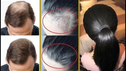 بالفيديو خلطة زيت الزيتون والعسل لها مفعول كالسحر على شعرك