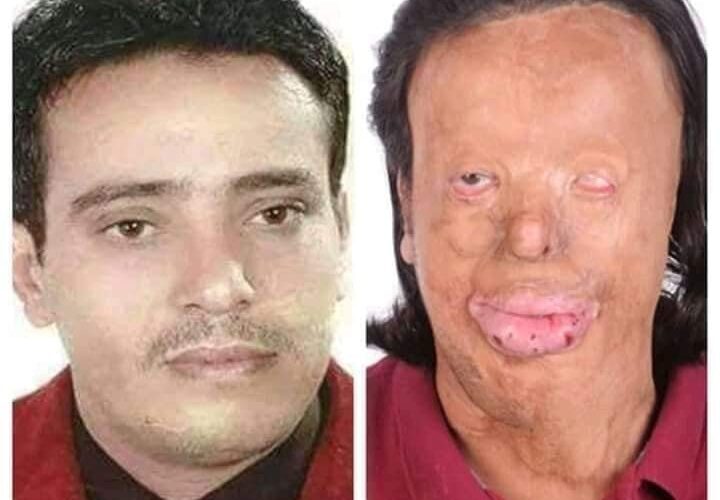 بعد طول أنتظار القضاء ينتصر لموظف وزارة الكهرباء عدنان المداني .