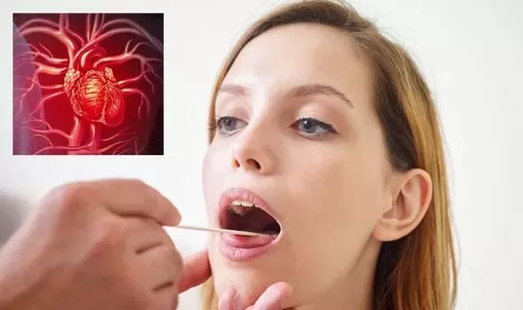 علامات واضحة تظهر على اللسان تؤكد وجود مشاكل خطيرة في القلب يجب عدم تجاهلها