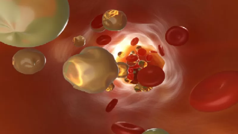 علامة واضحة على ارتفاع نسبة الكوليسترول تظهر حول رقبتك .. تعرف عليها فوراً ؟