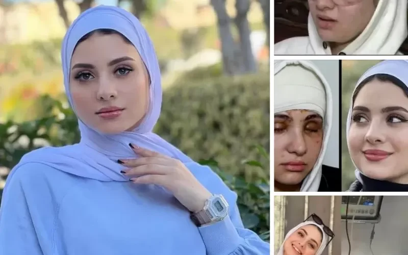 بالفيديو.. اعتداء مروع على بلوغر مصرية مشهورة يفقدها بصرها