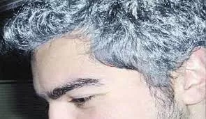 بملعقة قرنفل وبدون صبغات كيميائية .. تخلصي من الشعر الأبيض نهائيا بدون رجوعة مرة أخرى !