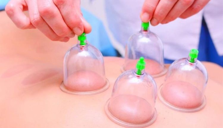 مختصة: هذا ما وجده العلماء في الدم المستخرج بعد الحجامة