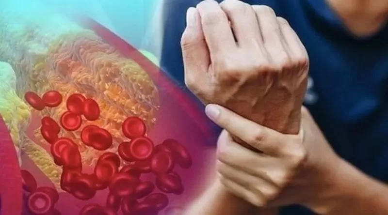 هذا ما يجب عليك فعله عندما تظهر عليك اعراض ارتفاع الكوليسترول لنسبة خطيرة قبل ان تباغت النوبة القلبية القاتلة