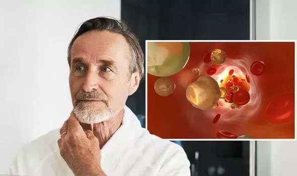 انتبه لهذه العلامة الواضحة في الوجه التي تدل على ارتفاع قاتل في الكوليسترول الضار في الدم