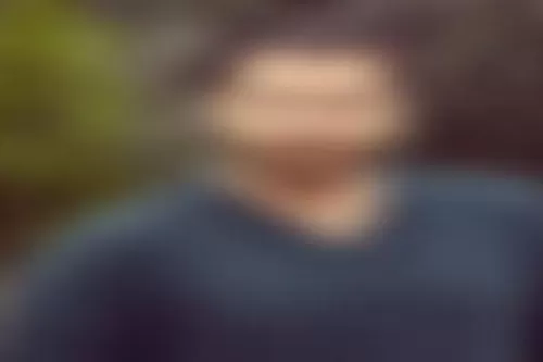 فنان شهر يعرفه العرب يصدم الجميع بتحوله جنسياً لحسناء كاملة الأنوثة والصور لا تصدق قبل وبعد