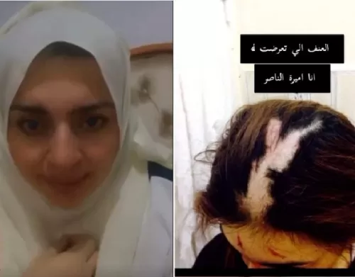 شاهد: مشهورة سناب “أميرة الناصر” تنهار باكية وتنشر صور تعرضها للضرب والعنف الجسدي