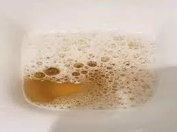 احذر قبل فوات الأوان.. من وجود رغوة اثناء البول تدل على مؤشرات خطيرة انتبه فورا !