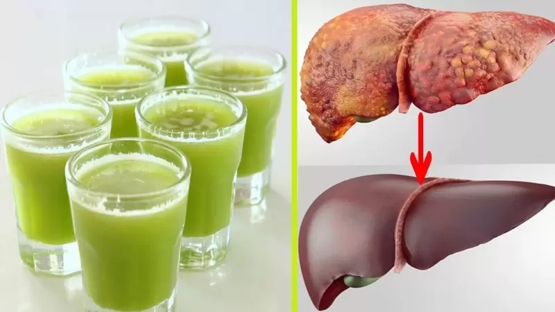 مشروبات طبيعية تطهر الكبد وتنظفه من السموم المتراكمة فيه وتذيب الدهون المتكونة عليه وتسبب مرض الكبد الدهني