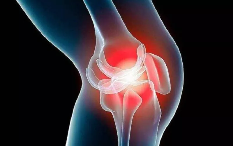 خبير سعودي يحذر من يعاني من التهاب المفاصل من 4 أطعمة يجب تجنبها فوراً